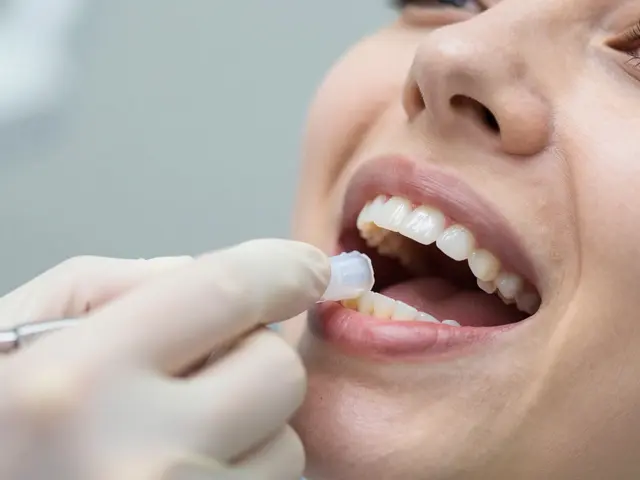 Jak dlouho trvá výroba otisků zubů pro sady na bělení?