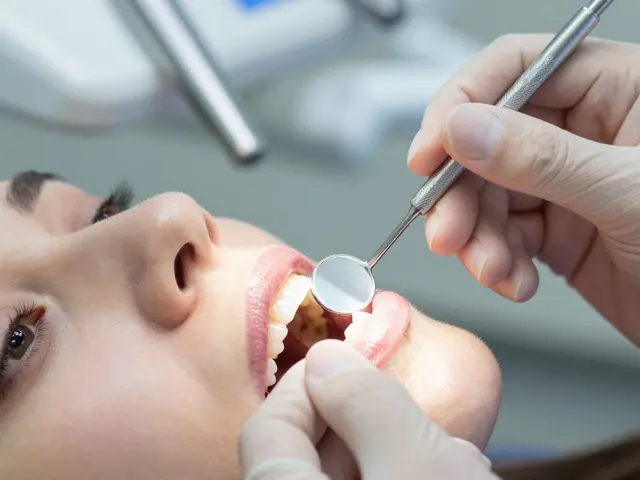 Fazety na zuby: Co byste měli vědět před zákrokem?