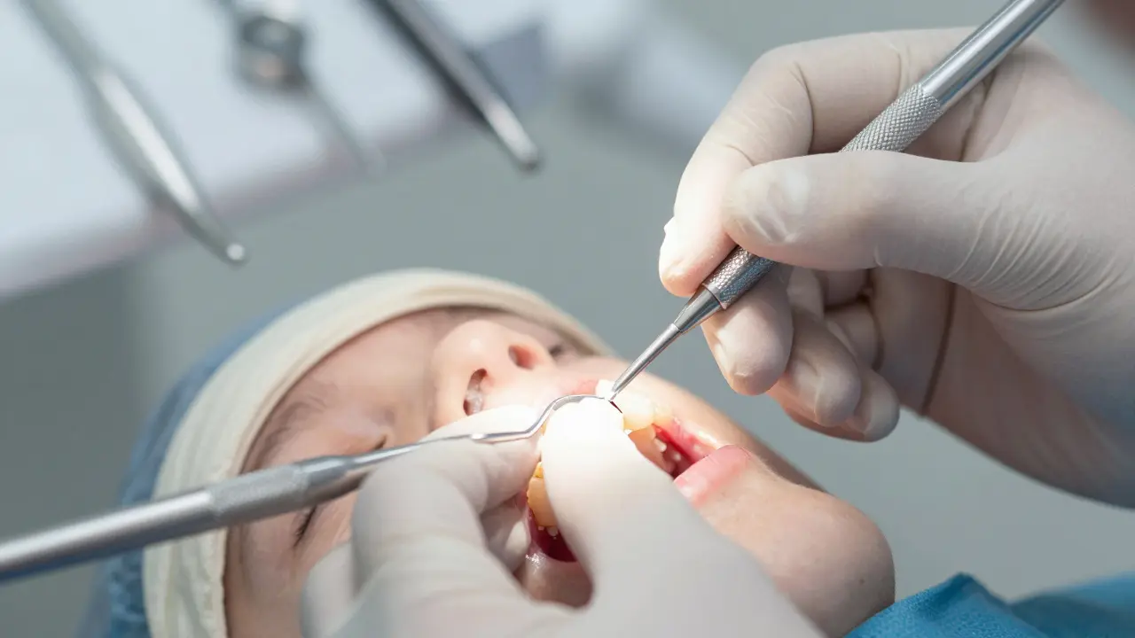 Jaké faktory ovlivňují cenu opravy ulomeného předního zubu? - Praktický průvodce