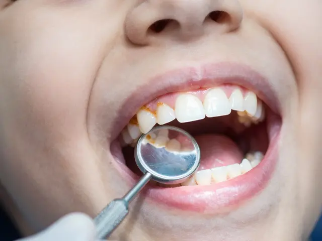 Proč je důležité řešit problém zubního kamene u dětí: Kompletní průvodce pro rodiče