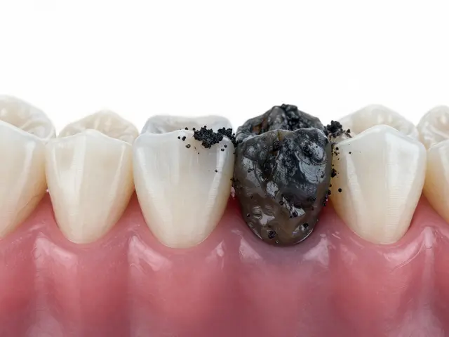 Černý zubní kámen: Co se stane při jeho odstranění u zubaře?