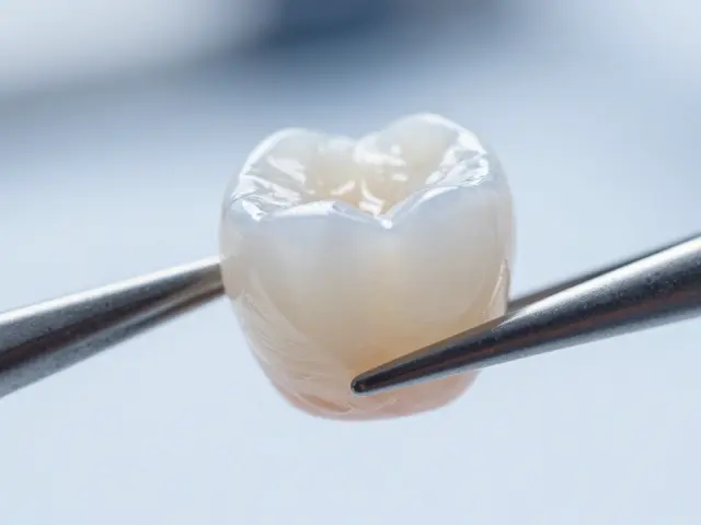 Celokeramické fazety: Jak tenké porcelánové destičky mění obličej a úsměv